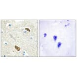 Immunohistochemistry - PLXDC1 Antibody from Signalway Antibody (33956) - Antibodies.com