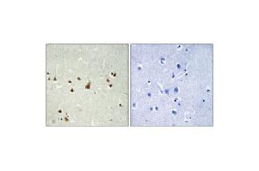 Immunohistochemistry - ANKRD26 Antibody from Signalway Antibody (34425) - Antibodies.com