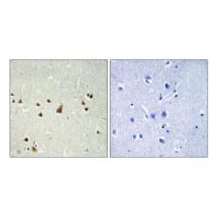 Immunohistochemistry - ANKRD26 Antibody from Signalway Antibody (34425) - Antibodies.com