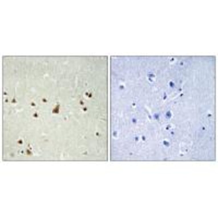 Immunohistochemistry - ANKRD26 Antibody from Signalway Antibody (34425) - Antibodies.com