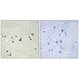 Immunohistochemistry - ANKRD26 Antibody from Signalway Antibody (34425) - Antibodies.com
