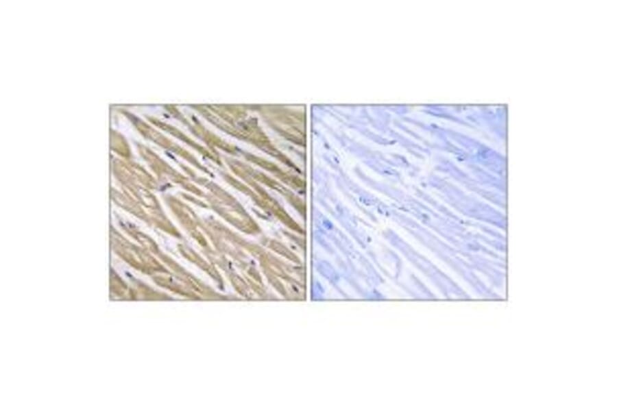Immunohistochemistry - C5orf13 Antibody from Signalway Antibody (34859) - Antibodies.com