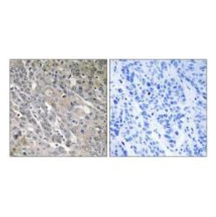 Immunohistochemistry - ARHGEF9 Antibody from Signalway Antibody (34997) - Antibodies.com