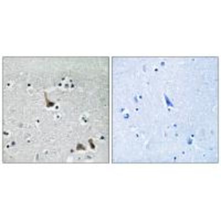 Immunohistochemistry - ATP6V1H Antibody from Signalway Antibody (35138) - Antibodies.com