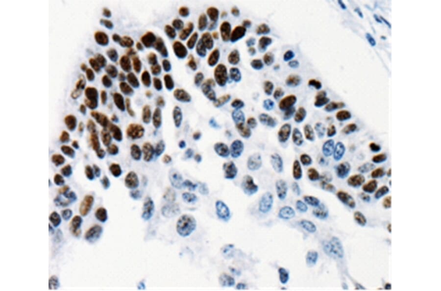 Immunohistochemistry - TGIF2LX Antibody from Signalway Antibody (35559) - Antibodies.com