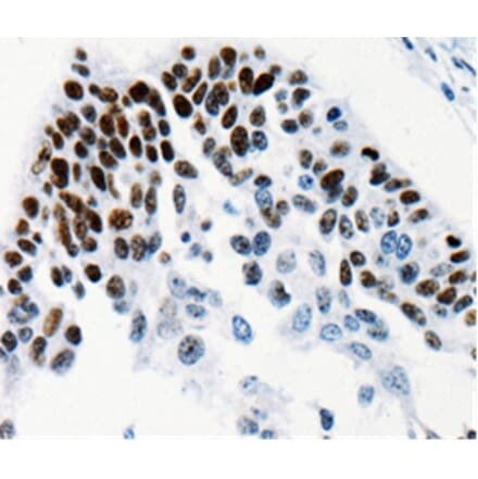Immunohistochemistry - TGIF2LX Antibody from Signalway Antibody (35559) - Antibodies.com