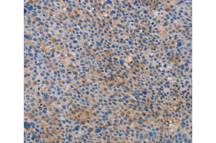 Immunohistochemistry - ALOX15B Antibody from Signalway Antibody (35563) - Antibodies.com