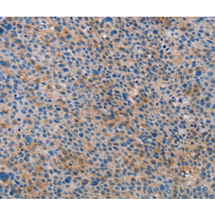 Immunohistochemistry - ALOX15B Antibody from Signalway Antibody (35563) - Antibodies.com