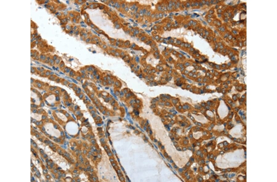Immunohistochemistry - IL12RB1 Antibody from Signalway Antibody (35600) - Antibodies.com