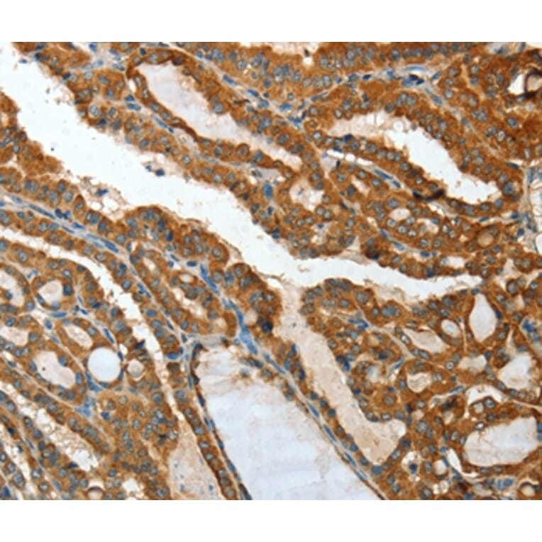 Immunohistochemistry - IL12RB1 Antibody from Signalway Antibody (35600) - Antibodies.com