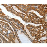 Immunohistochemistry - IL12RB1 Antibody from Signalway Antibody (35600) - Antibodies.com