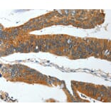 Immunohistochemistry - IL12RB1 Antibody from Signalway Antibody (35600) - Antibodies.com