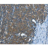 Immunohistochemistry - IL13RA2 Antibody from Signalway Antibody (35601) - Antibodies.com