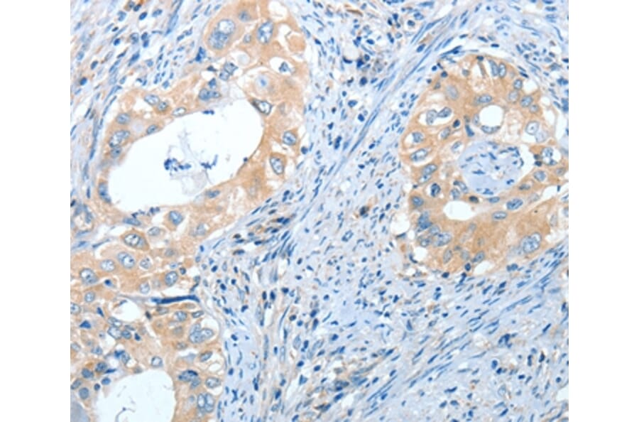 Immunohistochemistry - IL13RA2 Antibody from Signalway Antibody (35601) - Antibodies.com