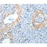 Immunohistochemistry - IL13RA2 Antibody from Signalway Antibody (35601) - Antibodies.com