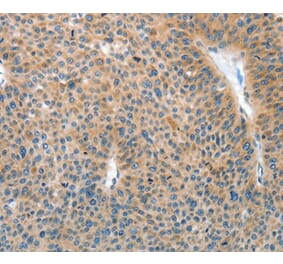 Immunohistochemistry - IL22RA1 Antibody from Signalway Antibody (35608) - Antibodies.com