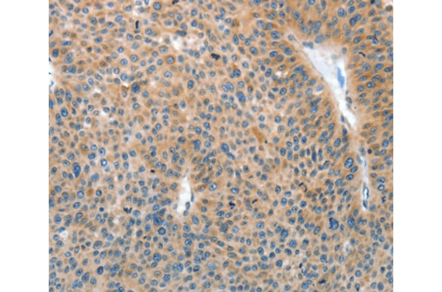 Immunohistochemistry - IL22RA1 Antibody from Signalway Antibody (35608) - Antibodies.com