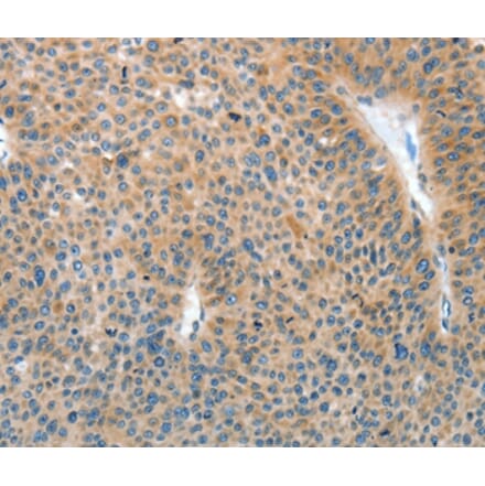 Immunohistochemistry - IL22RA1 Antibody from Signalway Antibody (35608) - Antibodies.com