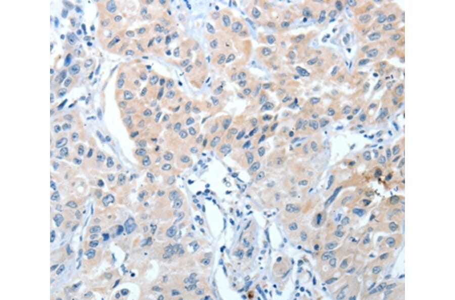 Immunohistochemistry - IL22RA1 Antibody from Signalway Antibody (35608) - Antibodies.com
