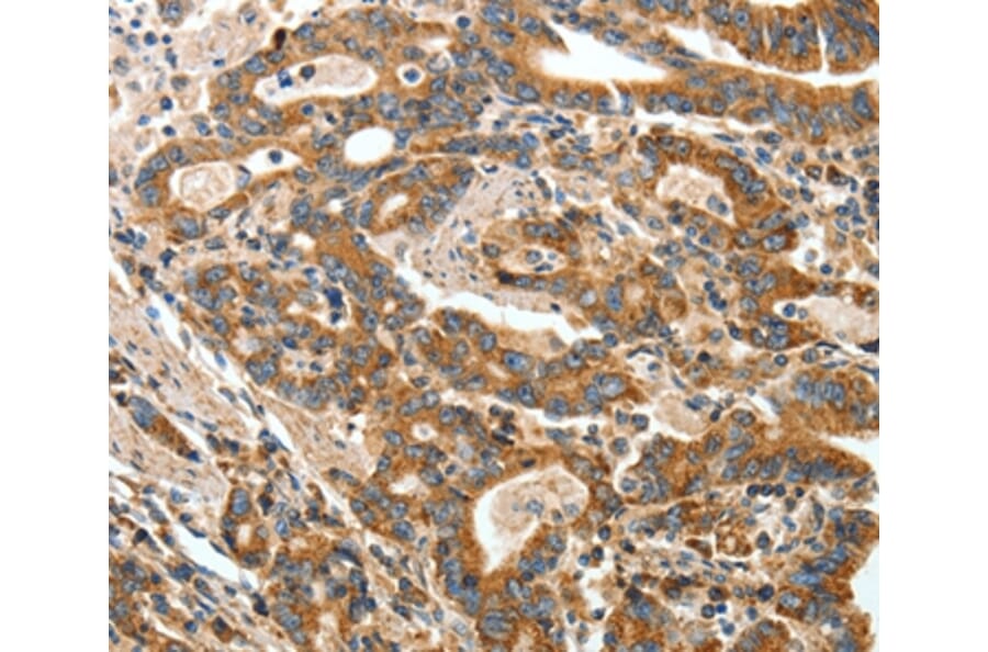 Immunohistochemistry - ANGPTL1 Antibody from Signalway Antibody (35617) - Antibodies.com