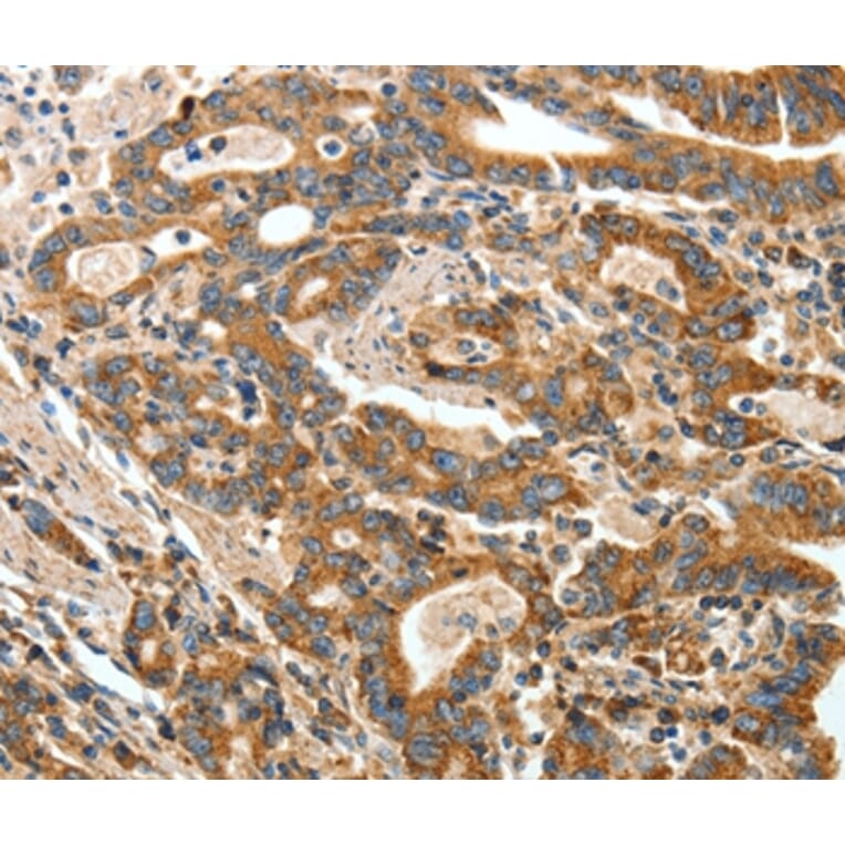 Immunohistochemistry - ANGPTL1 Antibody from Signalway Antibody (35617) - Antibodies.com