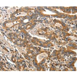 Immunohistochemistry - ANGPTL1 Antibody from Signalway Antibody (35617) - Antibodies.com