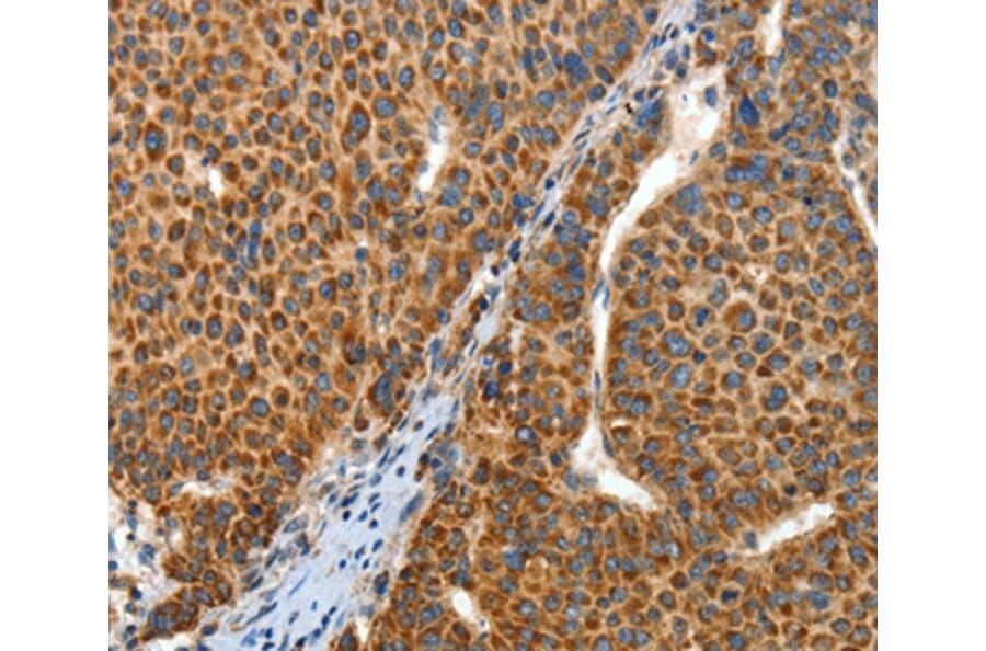 Immunohistochemistry - ANGPTL1 Antibody from Signalway Antibody (35617) - Antibodies.com