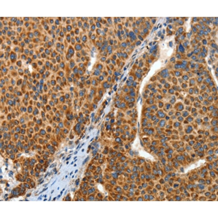 Immunohistochemistry - ANGPTL1 Antibody from Signalway Antibody (35617) - Antibodies.com