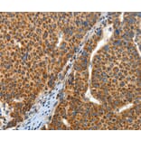 Immunohistochemistry - ANGPTL1 Antibody from Signalway Antibody (35617) - Antibodies.com