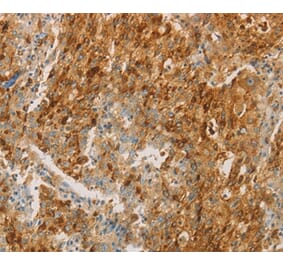 Immunohistochemistry - CEACAM8 Antibody from Signalway Antibody (35678) - Antibodies.com