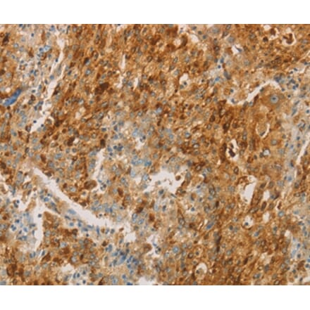 Immunohistochemistry - CEACAM8 Antibody from Signalway Antibody (35678) - Antibodies.com