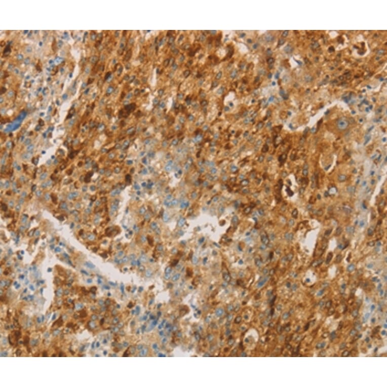 Immunohistochemistry - CEACAM8 Antibody from Signalway Antibody (35678) - Antibodies.com