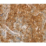 Immunohistochemistry - CEACAM8 Antibody from Signalway Antibody (35678) - Antibodies.com
