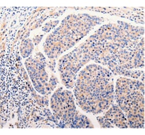 Immunohistochemistry - CLEC10A Antibody from Signalway Antibody (35687) - Antibodies.com
