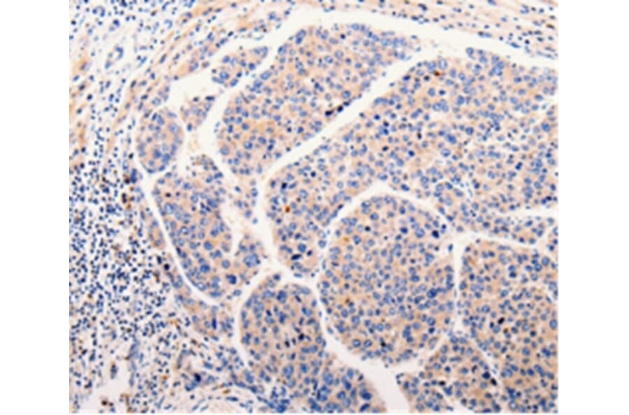 Immunohistochemistry - CLEC10A Antibody from Signalway Antibody (35687) - Antibodies.com