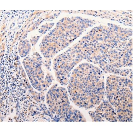 Immunohistochemistry - CLEC10A Antibody from Signalway Antibody (35687) - Antibodies.com