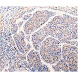 Immunohistochemistry - CLEC10A Antibody from Signalway Antibody (35687) - Antibodies.com