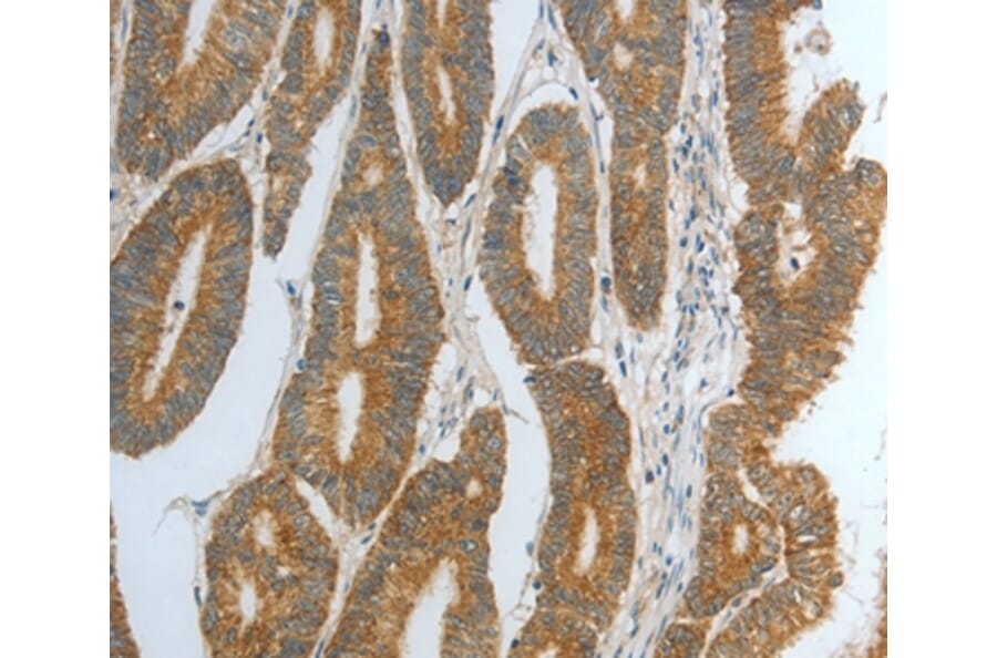 Immunohistochemistry - DNAJC10 Antibody from Signalway Antibody (35859) - Antibodies.com