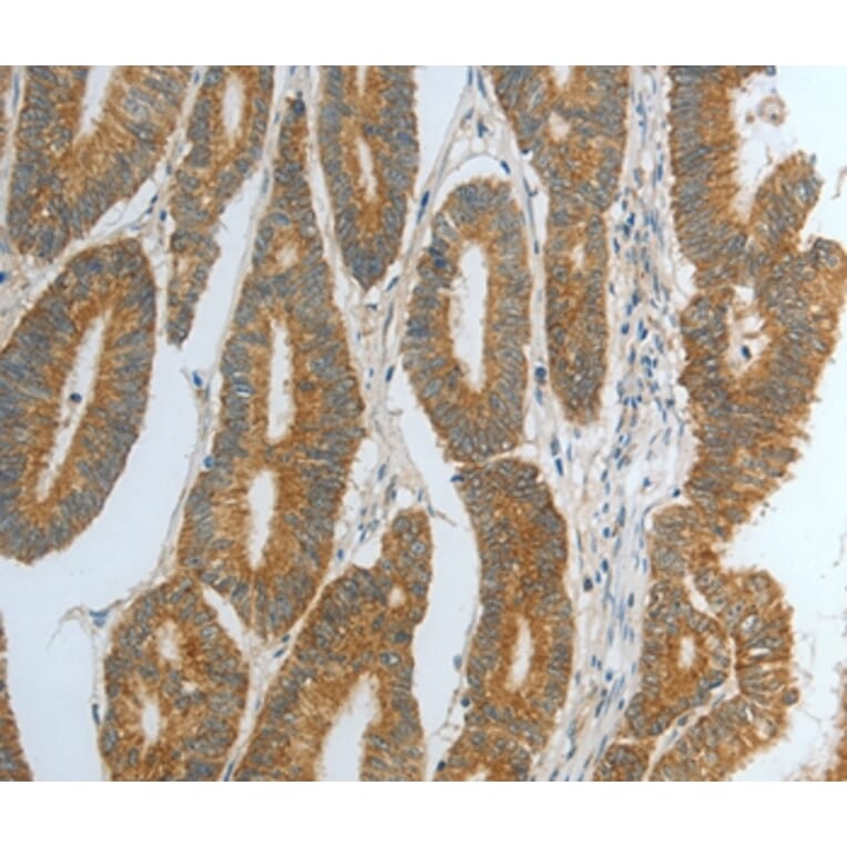 Immunohistochemistry - DNAJC10 Antibody from Signalway Antibody (35859) - Antibodies.com