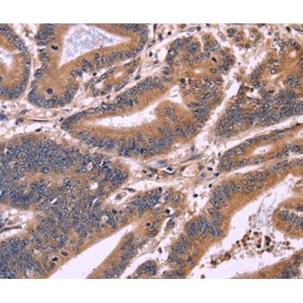 Immunohistochemistry - S100A13 Antibody from Signalway Antibody (35909) - Antibodies.com