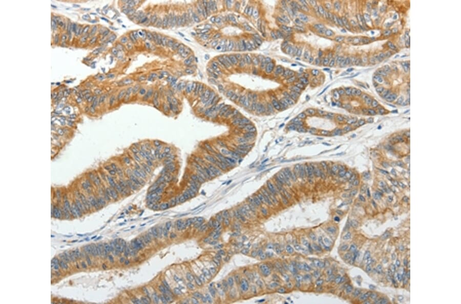 Immunohistochemistry - SLC12A4 Antibody from Signalway Antibody (35916) - Antibodies.com
