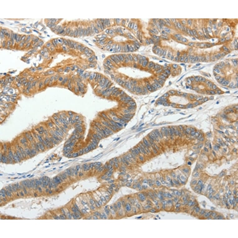 Immunohistochemistry - SLC12A4 Antibody from Signalway Antibody (35916) - Antibodies.com