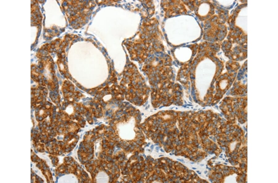 Immunohistochemistry - SLC12A4 Antibody from Signalway Antibody (35916) - Antibodies.com