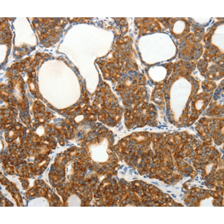 Immunohistochemistry - SLC12A4 Antibody from Signalway Antibody (35916) - Antibodies.com