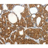 Immunohistochemistry - SLC12A4 Antibody from Signalway Antibody (35916) - Antibodies.com
