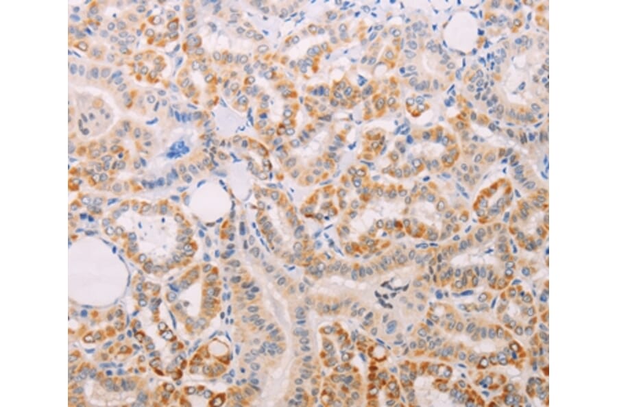Immunohistochemistry - MAP3K12 Antibody from Signalway Antibody (35948) - Antibodies.com