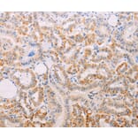 Immunohistochemistry - MAP3K12 Antibody from Signalway Antibody (35948) - Antibodies.com