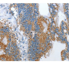 Immunohistochemistry - RARRES3 Antibody from Signalway Antibody (35961) - Antibodies.com