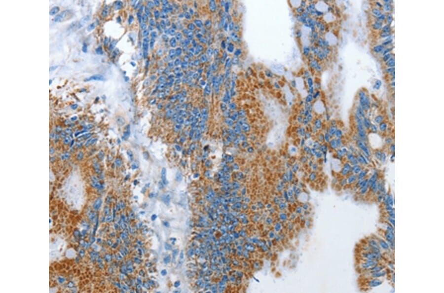 Immunohistochemistry - RARRES3 Antibody from Signalway Antibody (35961) - Antibodies.com