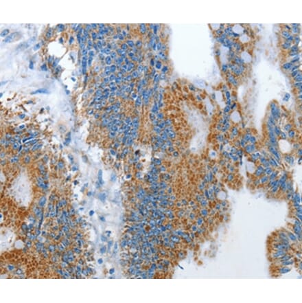 Immunohistochemistry - RARRES3 Antibody from Signalway Antibody (35961) - Antibodies.com